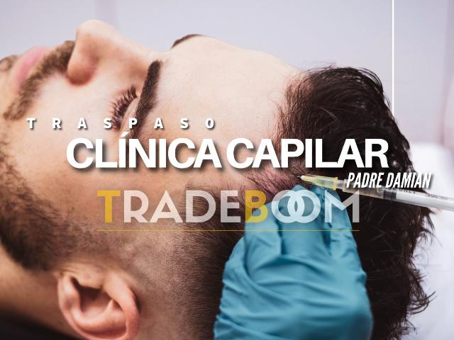 TRASPASO DE CLINICA DE TRASPLANTE CAPILAR EN MADRID